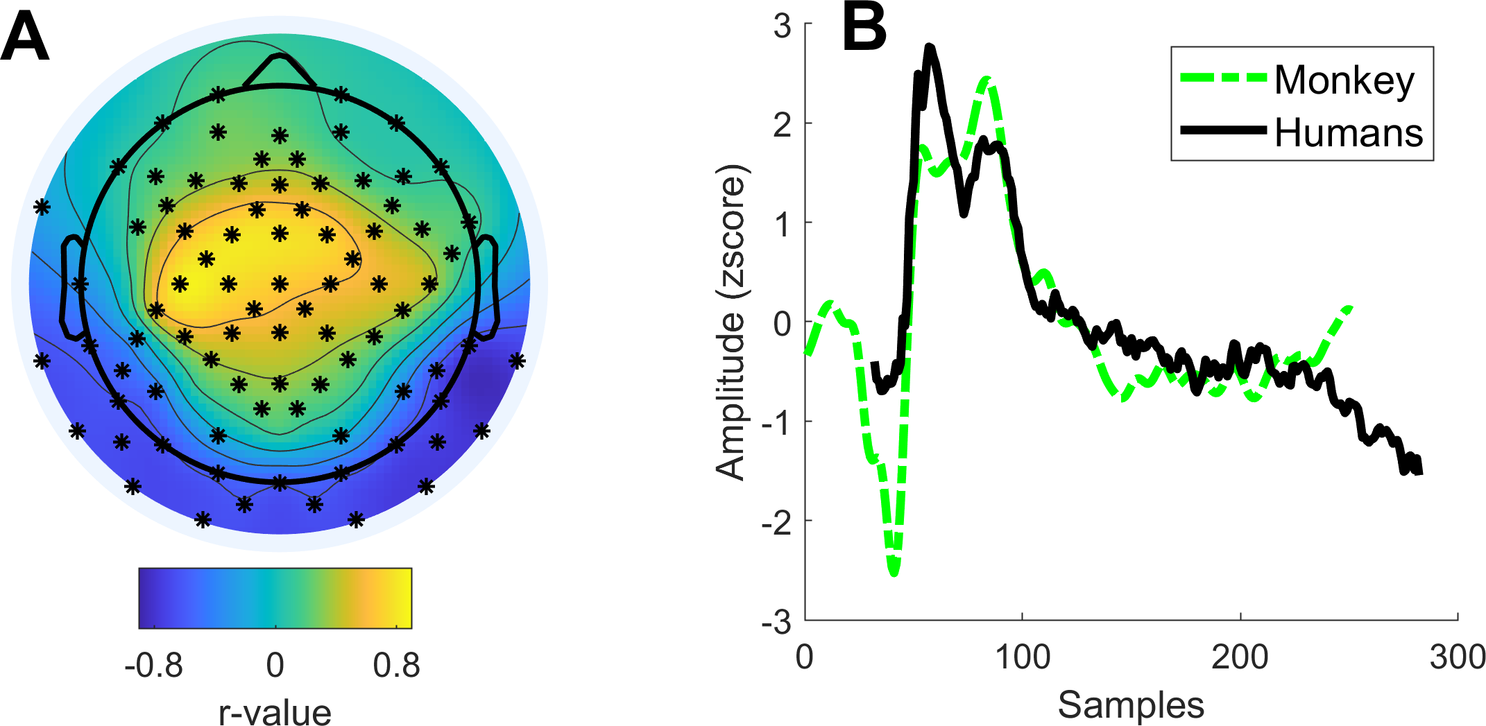 Common neural mechanisms supporting time judgements in 