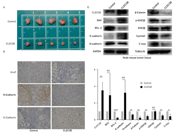 Effect of CLEC3B on tumor formation of bile duct cancer cells in vivo.