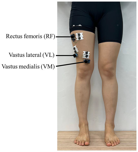 Comparison of the vastus medialis activity during descending stairs (expressed in %MVIC).