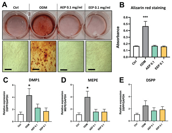 Effects of AEP and EEP on DPSC differentiation.