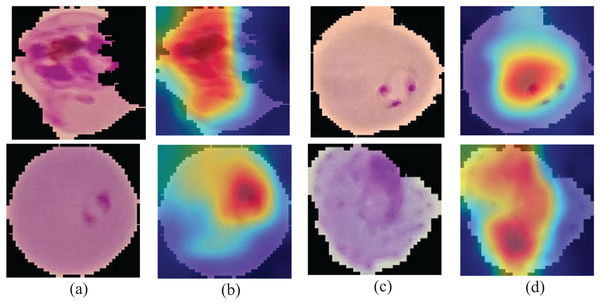 Learning patterns of the malaria cells on the average pool using Grad-CAM (A and C) and microscopic images (B and D).