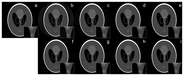 Shepp–Logan phantom reconstruction results from 64-view projections with 37 dB noise level: (A) ground truth, (B) FBP, (C) SART, (D) SART+TV, (E) SART+BM3D (
$\sigma = 0.35$σ=0.35
), (F) SART+BM3D (
$\sigma = 0.20$σ=0.20
), (G) DIP+TV, (H) FBP+U-Net, (I) Proj2Proj trained on ellipses dataset.