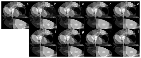 Ellipses image reconstruction results from 64-view projections with 33 dB noise level: (A) ground truth, (B) FBP, (C) SART, (D) SART+TV, (E) SART+BM3D (
$\sigma = 0.35$σ=0.35
), (F) SART+BM3D (
$\sigma = 0.20$σ=0.20
), (G) DIP+TV, (H) FBP+U-Net, (I) Proj2Proj trained on ellipses dataset.