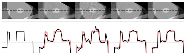 The 1-D profiles of the reconstructions from left to right: ground truth, SART+BM3D (
$\sigma = 0.20$σ=0.20
), DIP+TV, FBP+U-Net, proposed Proj2Proj method.