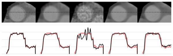 The 1-D profiles of the reconstructions from left to right: ground truth, SART+BM3D (
$\sigma = 0.20$σ=0.20
), DIP+TV, FBP+U-Net, proposed Proj2Proj method.