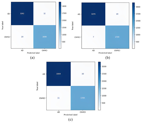 1 vs All classification confusion matrices (AD/CNMCI).