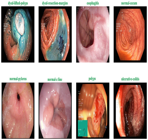 Sample of various gastrointestinal diseases.