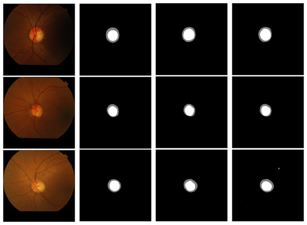 Visualization comparison of the addition of residual modules at different stages: (A) original image, (B) label, (C) encoder, (D) encoder & decoder.