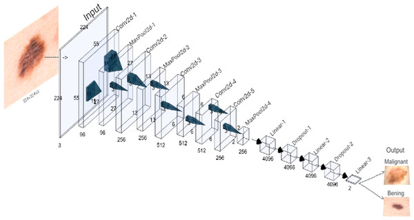 AlexNet architecture of the proposed CNN.