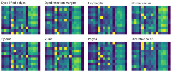 Attention maps learned by the model correspond to 8 classes for an input sample.