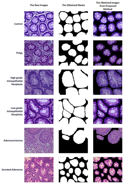 Sample of raw images, masks and proposed method outputs.