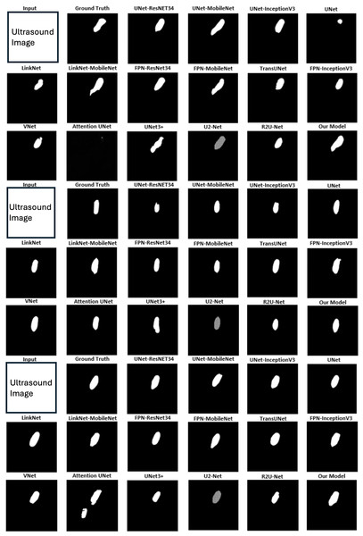 The segmentation results of different networks on the brachial plexus nerve testing dataset.