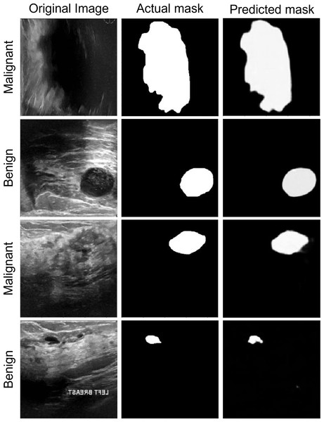 The segmentation performance of the proposed model on ultrasound images.