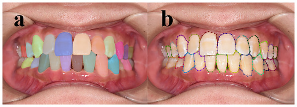 Comparison of machine-drawn tooth contours and contours annotated by senior dentists.